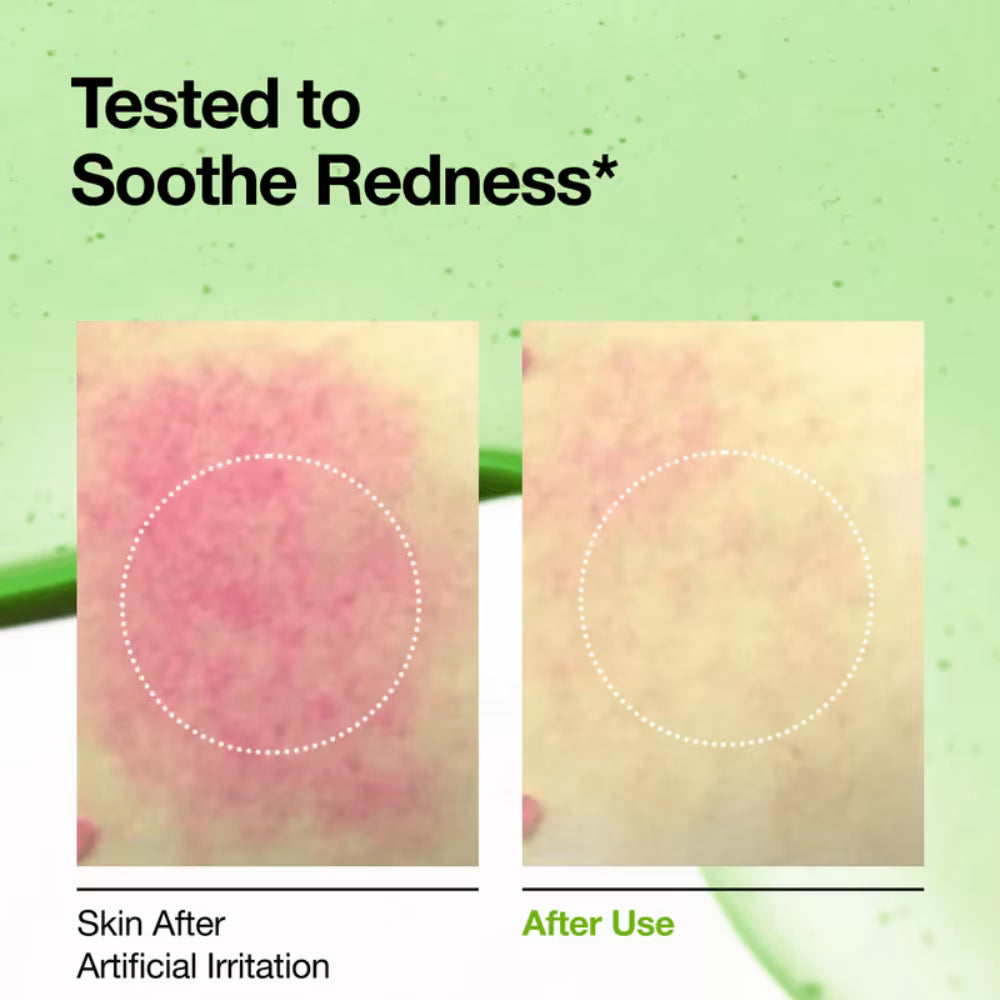 Anua Azelaic Acid 10 Hyaluron Redness Soothing Serum