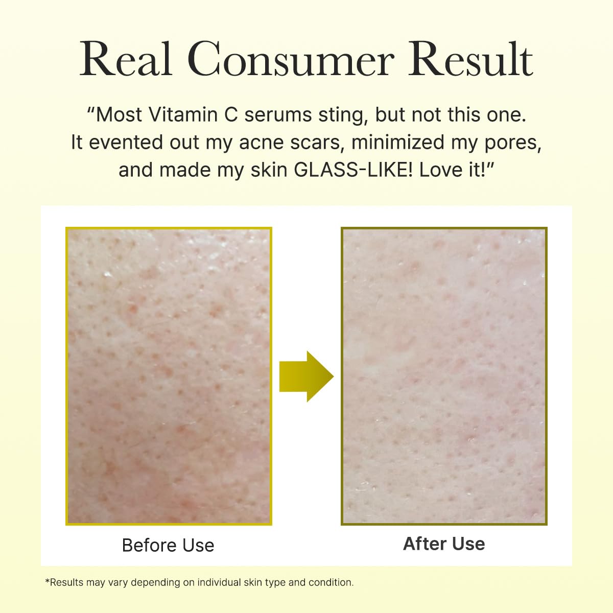 Arencia - Vitamin C Booster Shot Serum [30ml] - Wardobie