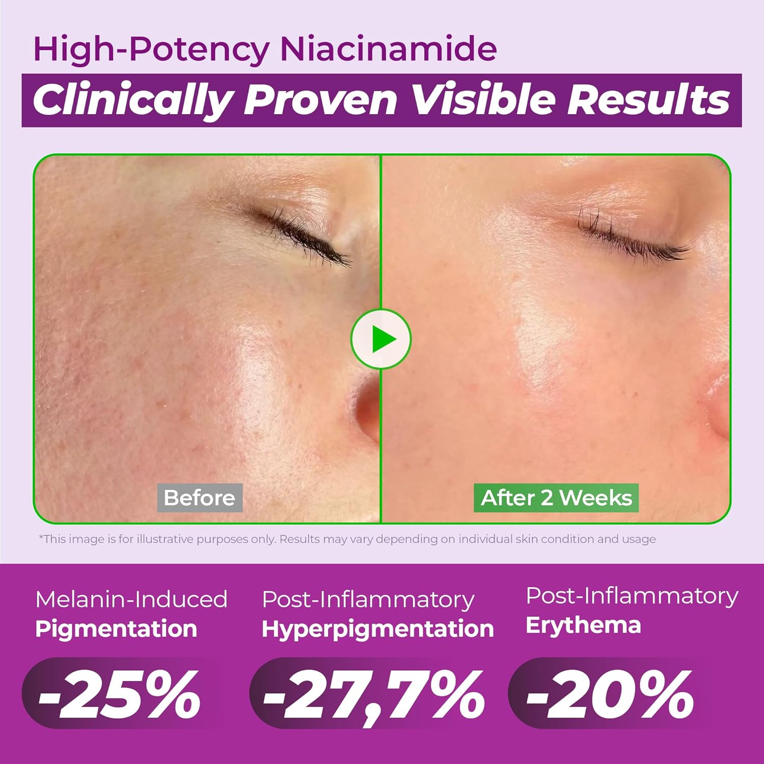 JUMISO - Niacinamide 20 Serum [40ml] - Wardobie