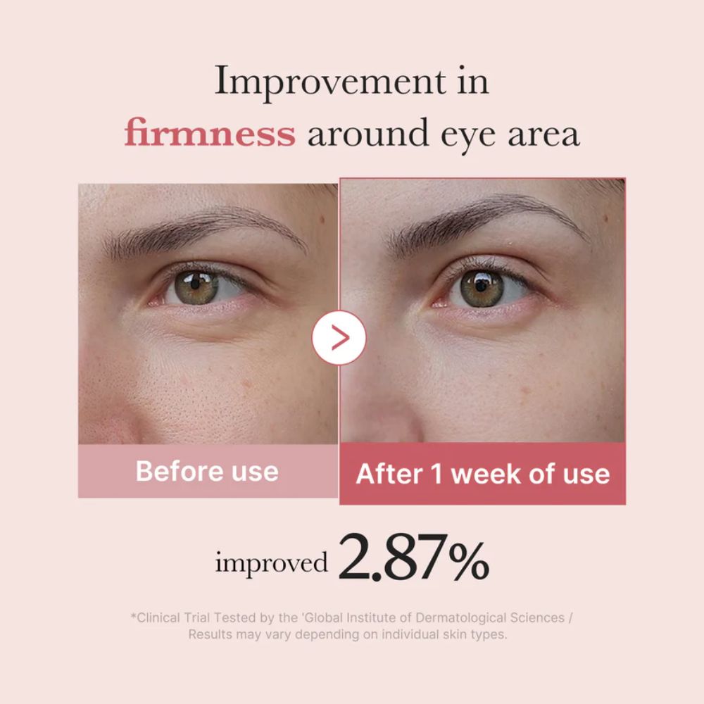 medicube - PDRN Pink Peptide Eye Cream 30ml