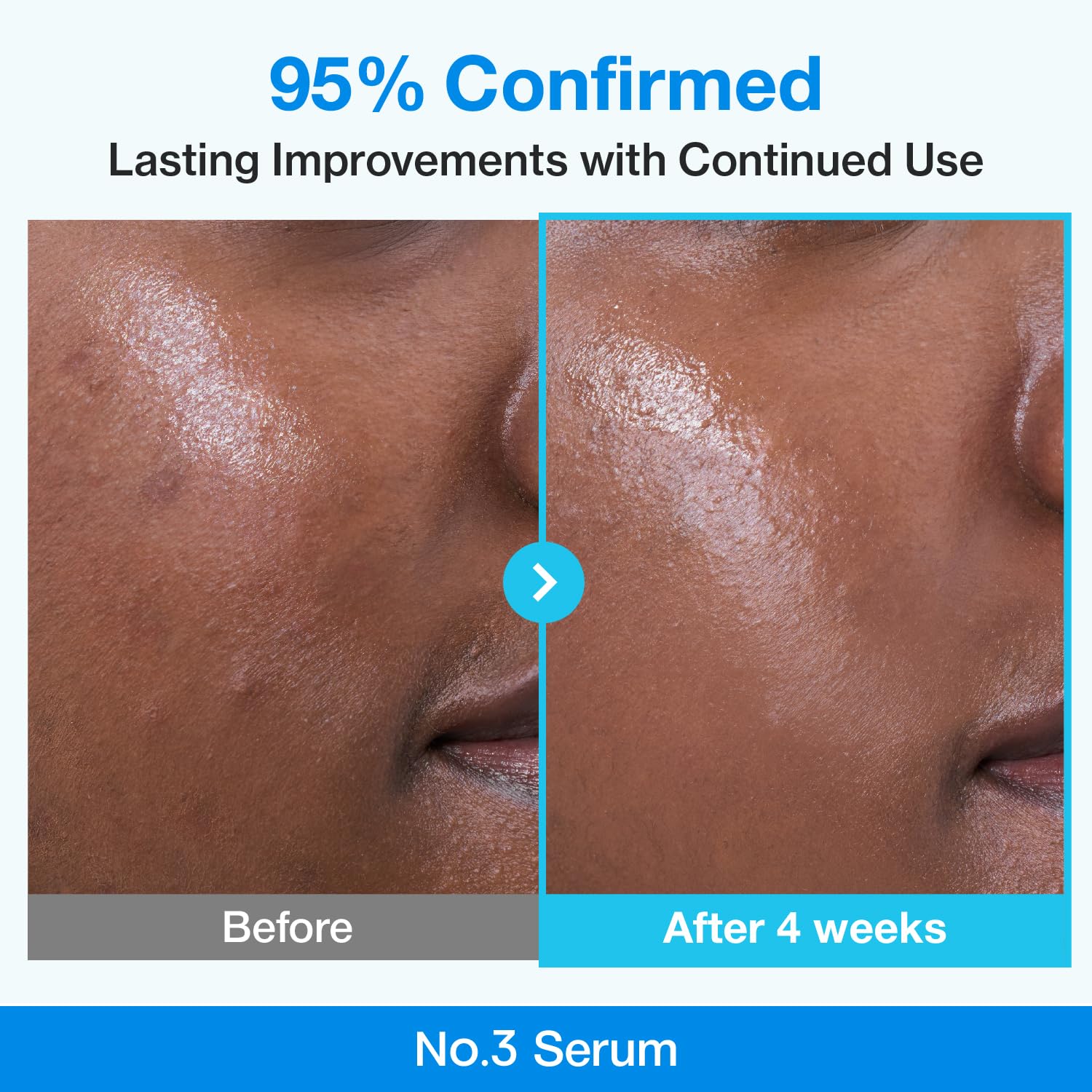numbuzin - No.3 Blue Bio-Retinol Pore Refining Serum [30ml] - Wardobie