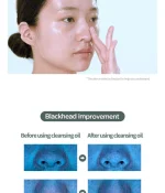 Anua - Heartleaf Pore Control Cleansing Oil - Image 6