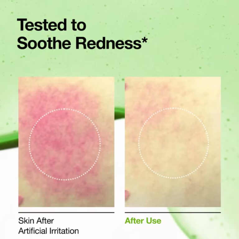 Anua Azelaic Acid 10 Hyaluron Redness Soothing Serum