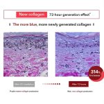 Centellian24 - Madeca Cream Time Reverse