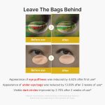 medicube - kojic acid turmeric vita eye gel serum [30ml] - Image 4