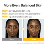 numbuzin - No.5 Glutathione TXA Advanced Dark Spot Ampoule Concentrate - Image 5